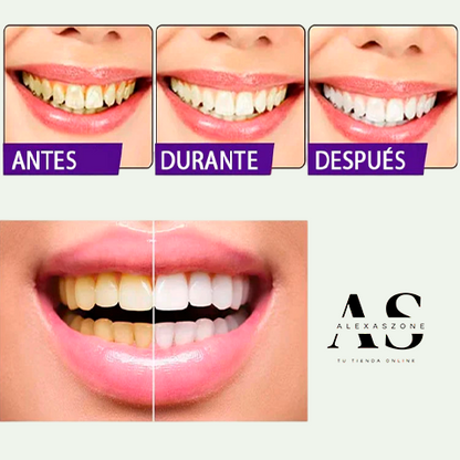 Blanqueador Dental para una Sonrisa Radiante al Instante